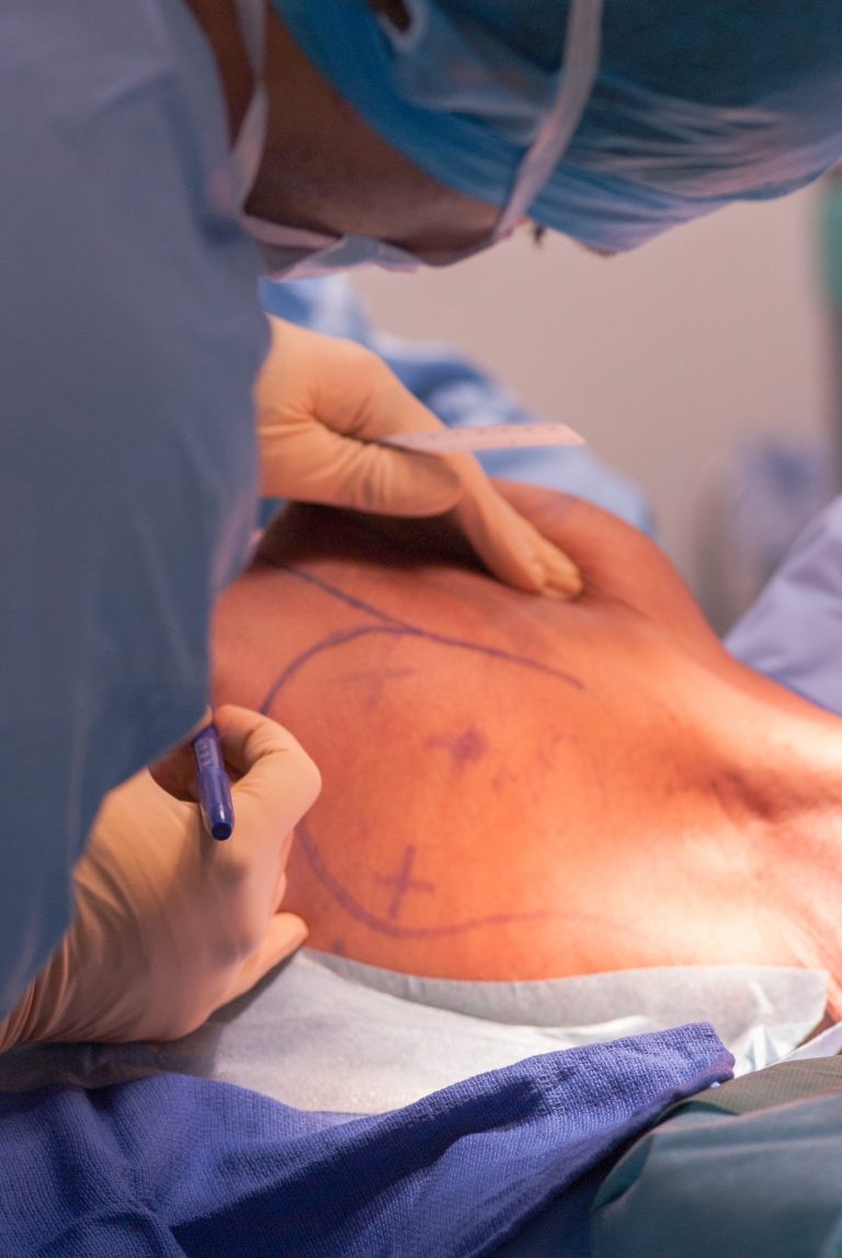 Parasacral Artery Perforator Flap